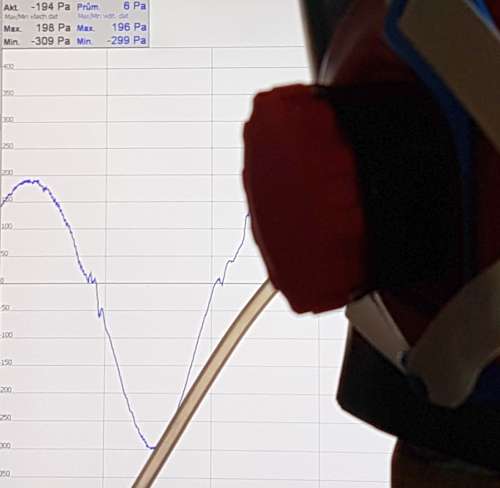 Measurement of breathing resistance